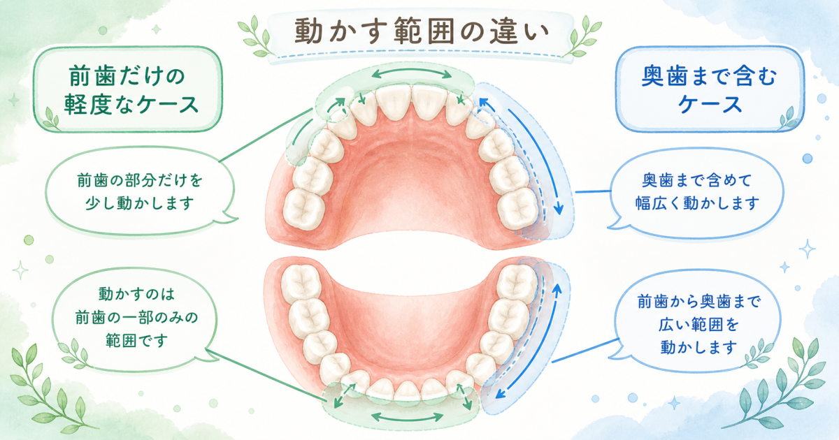 出っ歯・すきっ歯を部分矯正で改善できる条件と適用される限界