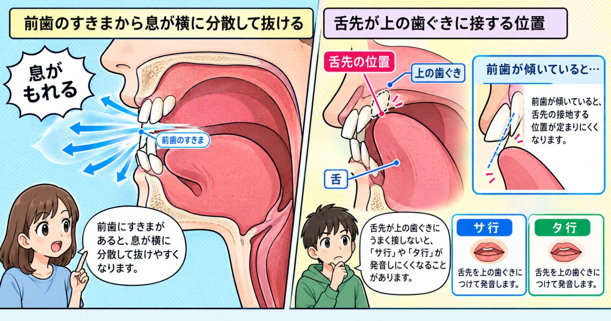 すきっ歯や噛み合わせのズレが発音に影響する仕組み